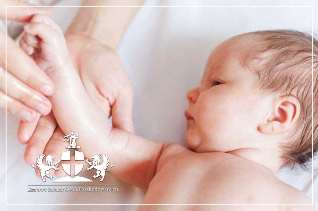 Zdjęcie 2.1 przedstawia niemowlę u którego stwierdzono uszkodzenie splotu barkowego, czy li struktur nerwowych w odcinku szyjno-barkowym. Fizjoterapeuta dziecięcy katowice będzie tutaj musiał wykonać specjalistyczne działania terapeutyczne, aby uzyskać znaczącą poprawę. Dodatkowo może okazać się koniecznym włączenie dodatkowego specjalisty, którym jest osteopata katowice, gdyż tylko takie całościowe podejście może usprawnić to dziecko w pełni.